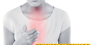 Bruciori di stomaco: stai attento a questi alimenti bruciori di stomaco