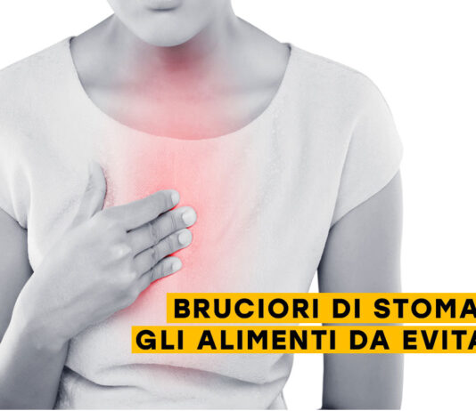 Bruciori di stomaco: stai attento a questi alimenti bruciori di stomaco