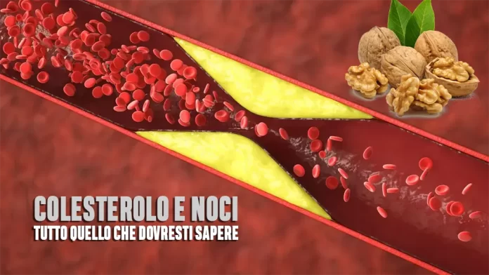 Colesterolo noci